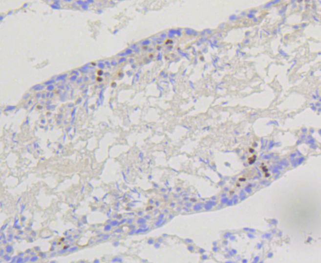 Immunohistochemical analysis of paraffin-embedded rat testis tissue using anti-PI 3 Kinase p85 beta antibody. The section was pre-treated using heat mediated antigen retrieval with Tris-EDTA buffer (pH 9.0) for 20 minutes.The tissues were blocked in 5% BSA for 30 minutes at room temperature, washed with ddH2O and PBS, and then probed with the primary antibody (ET1609-30, 1/50) for 30 minutes at room temperature. The detection was performed using an HRP conjugated compact polymer system. DAB was used as the chromogen. Tissues were counterstained with hematoxylin and mounted with DPX.