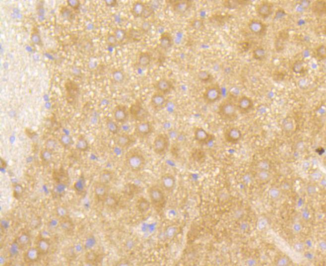 Immunohistochemical analysis of paraffin-embedded rat brain tissue using anti-PI 3 Kinase p85 beta antibody. The section was pre-treated using heat mediated antigen retrieval with Tris-EDTA buffer (pH 9.0) for 20 minutes.The tissues were blocked in 5% BSA for 30 minutes at room temperature, washed with ddH2O and PBS, and then probed with the primary antibody (ET1609-30, 1/50) for 30 minutes at room temperature. The detection was performed using an HRP conjugated compact polymer system. DAB was used as the chromogen. Tissues were counterstained with hematoxylin and mounted with DPX.