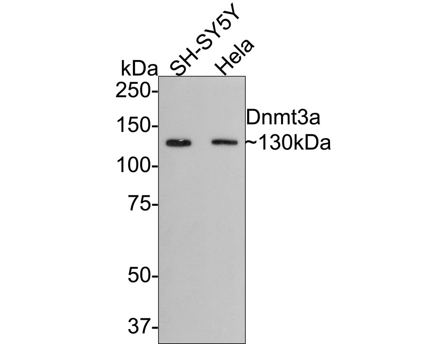 Western blot analysis of Dnmt3a on different lysates. Proteins were transferred to a PVDF membrane and blocked with 5% BSA in PBS for 1 hour at room temperature. The primary antibody (ET1609-31, 1/500) was used in 5% BSA at room temperature for 2 hours. Goat Anti-Rabbit IgG - HRP Secondary Antibody (HA1001) at 1:5,000 dilution was used for 1 hour at room temperature.<br />
Positive control: <br />
Lane 1: Hela cell lysate<br />
Lane 2: human brain tissue lysate<br />
Lane 3: human heart tissue lysate