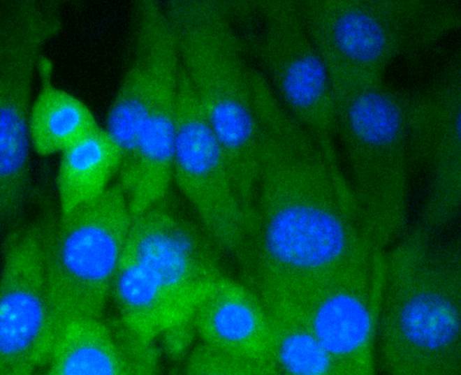 ICC staining of Dnmt3a in Hela cells (green). Formalin fixed cells were permeabilized with 0.1% Triton X-100 in TBS for 10 minutes at room temperature and blocked with 1% Blocker BSA for 15 minutes at room temperature. Cells were probed with the primary antibody (ET1609-31, 1/50) for 1 hour at room temperature, washed with PBS. Alexa Fluor®488 Goat anti-Rabbit IgG was used as the secondary antibody at 1/1,000 dilution. The nuclear counter stain is DAPI (blue).