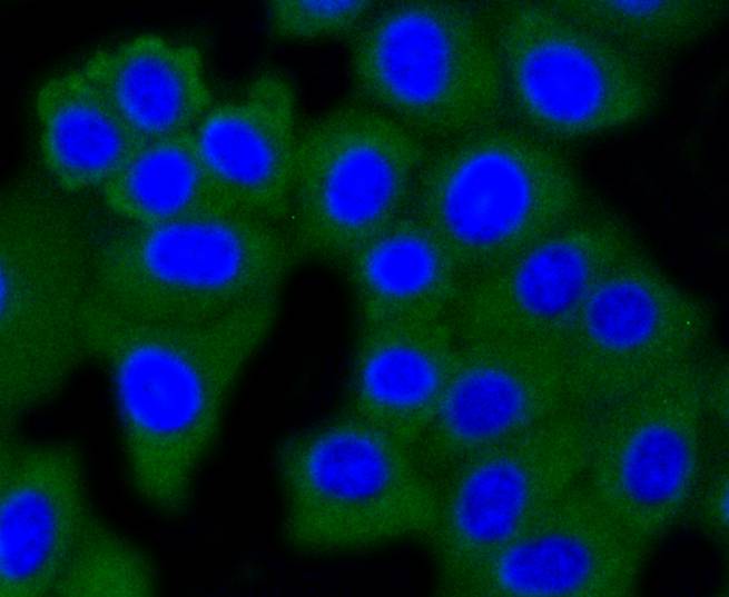 ICC staining of Dnmt3a in NIH/3T3 cells (green). Formalin fixed cells were permeabilized with 0.1% Triton X-100 in TBS for 10 minutes at room temperature and blocked with 1% Blocker BSA for 15 minutes at room temperature. Cells were probed with the primary antibody (ET1609-31, 1/50) for 1 hour at room temperature, washed with PBS. Alexa Fluor®488 Goat anti-Rabbit IgG was used as the secondary antibody at 1/1,000 dilution. The nuclear counter stain is DAPI (blue).