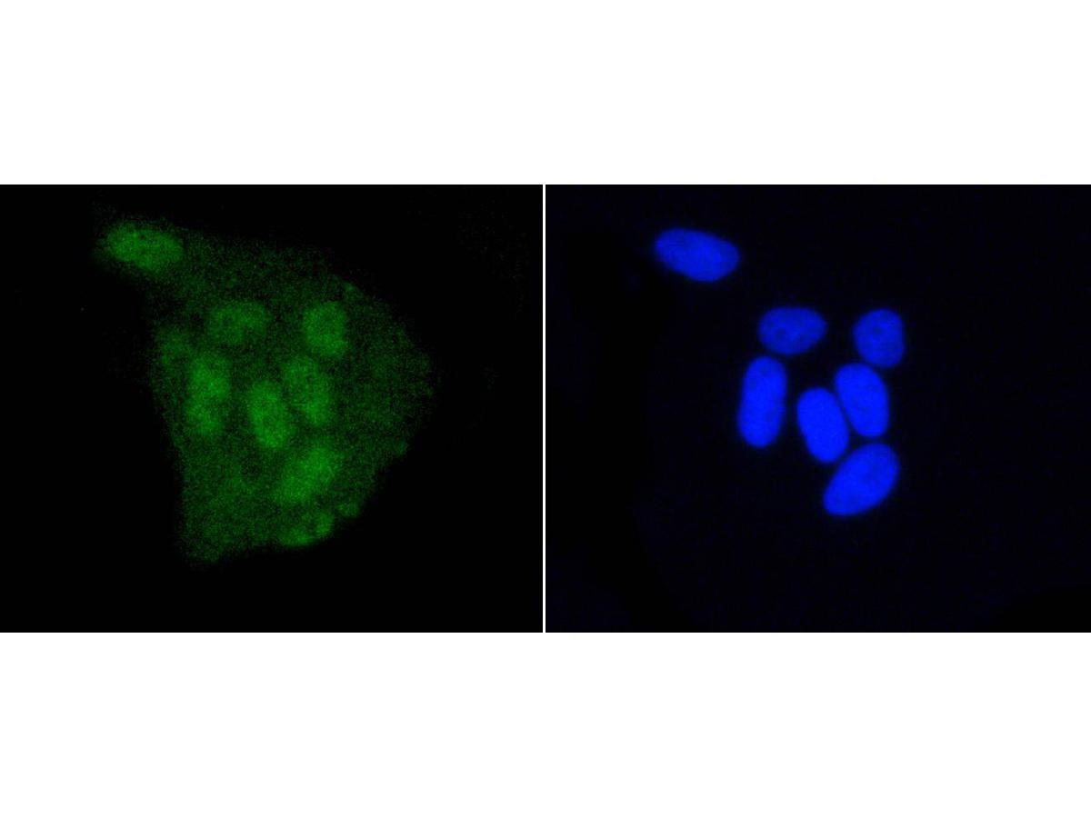 ICC staining DGCR8 (1/200) in Hela cells (green). The nuclear counter stain is DAPI (blue). Cells were fixed in paraformaldehyde, permeabilised with 0.25% Triton X100/PBS.