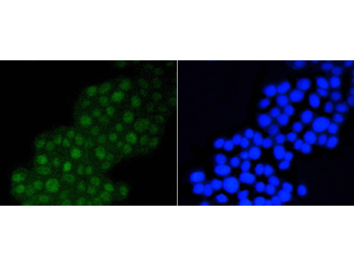 ICC staining DGCR8 (1/200) in PC12 cells (green). The nuclear counter stain is DAPI (blue). Cells were fixed in paraformaldehyde, permeabilised with 0.25% Triton X100/PBS.