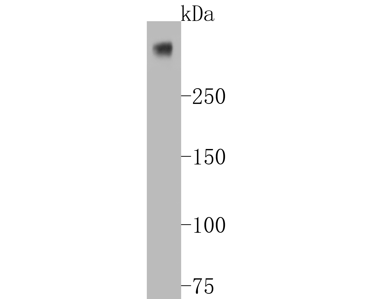 Anti Ki67 Antibody St50 01 Stratech