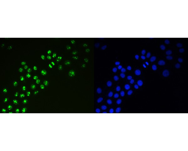 ICC staining of Ki67 in HepG2 cells (green). Formalin fixed cells were permeabilized with 0.1% Triton X-100 in TBS for 10 minutes at room temperature and blocked with 1% Blocker BSA for 15 minutes at room temperature. Cells were probed with the primary antibody (ET1609-34, 1/1,000) for 1 hour at room temperature, washed with PBS. Alexa Fluor®488 Goat anti-Rabbit IgG was used as the secondary antibody at 1/1,000 dilution. The nuclear counter stain is DAPI (blue).