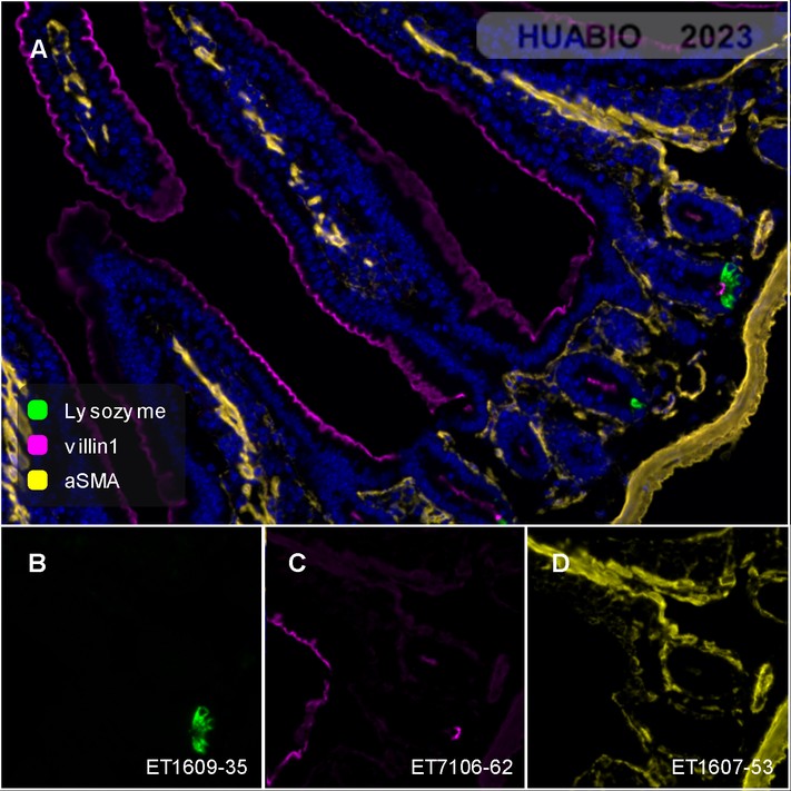 Fluorescence multiplex immunohistochemical analysis of mouse small intestine (Formalin/PFA-fixed paraffin-embedded sections). Panel A: the merged image of anti-Lysozyme (ET1609-35, Green), anti-villin1 (ET7106-62, Magenta) and anti-aSMA (ET1607-53, Yellow) on mouse small intestine. HRP Conjugated UltraPolymer Goat Polyclonal Antibody HA1119/HA1120 was used as a secondary antibody. The immunostaining was performed with the Sequential Immuno-staining Kit (IRISKit™MH010101, www.luminiris.cn). The section was incubated in three rounds of staining: in the order of ET1609-35 (1/2,000 dilution), ET7106-62 (1/5,000 dilution) and ET1607-53 (1/10,000 dilution) for 20 mins at room temperature. Each round was followed by a separate fluorescent tyramide signal amplification system. Heat mediated antigen retrieval with Tris-EDTA buffer (pH 9.0) for 30 mins at 95℃. DAPI (blue) was used as a nuclear counter stain. Image acquisition was performed with Olympus VS200 Slide Scanner.