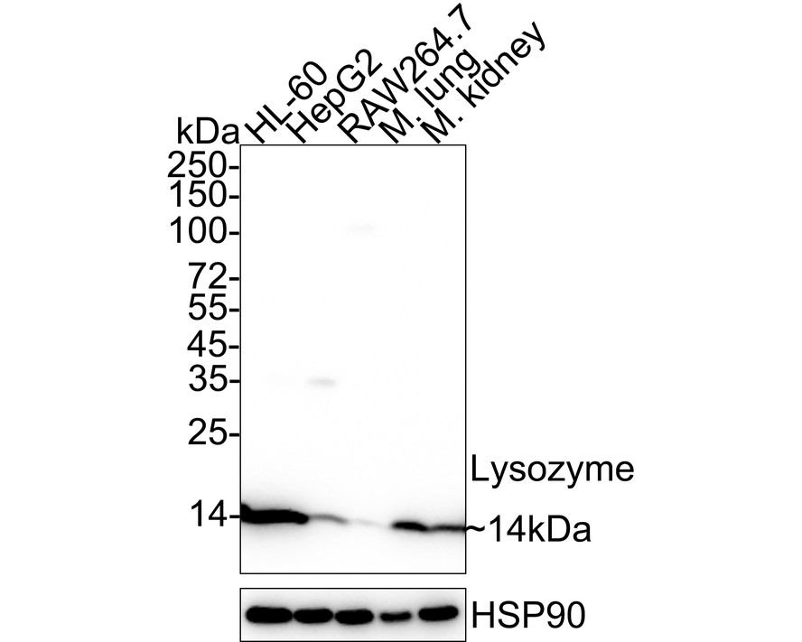 Western blot analysis of Lysozyme on different lysates with Rabbit anti-Lysozyme antibody (ET1609-35) at 1/2,000 dilution.<br />
<br />
Lane 1: Human kidney tissue lysate<br />
Lane 2: HL-60 cell lysate<br />
<br />
Lysates/proteins at 20 µg/Lane.<br />
<br />
Predicted band size: 17 kDa<br />
Observed band size: 14 kDa<br />
<br />
Exposure time: 24 seconds;<br />
<br />
4-20% SDS-PAGE gel.<br />
<br />
Proteins were transferred to a PVDF membrane and blocked with 5% NFDM/TBST for 1 hour at room temperature. The primary antibody (ET1609-35) at 1/2,000 dilution was used in 5% NFDM/TBST at 4℃ overnight. Goat Anti-Rabbit IgG - HRP Secondary Antibody (HA1001) at 1:50,000 dilution was used for 1 hour at room temperature.