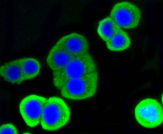 ICC staining of Lysozyme in CRC cells (green). Formalin fixed cells were permeabilized with 0.1% Triton X-100 in TBS for 10 minutes at room temperature and blocked with 1% Blocker BSA for 15 minutes at room temperature. Cells were probed with the primary antibody (ET1609-35, 1/50) for 1 hour at room temperature, washed with PBS. Alexa Fluor®488 Goat anti-Rabbit IgG was used as the secondary antibody at 1/1,000 dilution. The nuclear counter stain is DAPI (blue).
