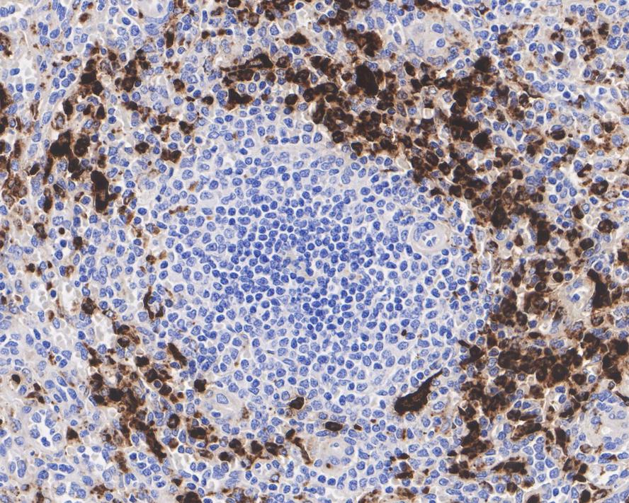 Immunohistochemical analysis of paraffin-embedded human tonsil tissue with Rabbit anti-Lysozyme antibody (ET1609-35) at 1/200 dilution.<br />
<br />
The section was pre-treated using heat mediated antigen retrieval with Tris-EDTA buffer (pH 9.0) for 20 minutes. The tissues were blocked in 1% BSA for 20 minutes at room temperature, washed with ddH2O and PBS, and then probed with the primary antibody (ET1609-35) at 1/200 dilution for 1 hour at room temperature. The detection was performed using an HRP conjugated compact polymer system. DAB was used as the chromogen. Tissues were counterstained with hematoxylin and mounted with DPX.