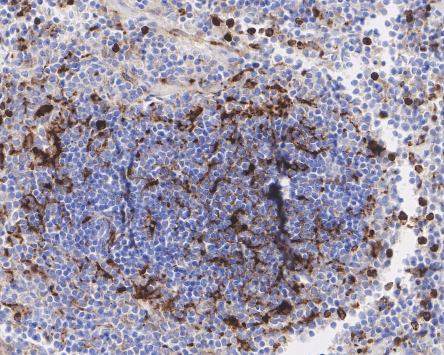 Immunohistochemical analysis of paraffin-embedded human spleen tissue with Rabbit anti-Lysozyme antibody (ET1609-35) at 1/500 dilution.<br />
<br />
The section was pre-treated using heat mediated antigen retrieval with Tris-EDTA buffer (pH 9.0) for 20 minutes. The tissues were blocked in 1% BSA for 20 minutes at room temperature, washed with ddH2O and PBS, and then probed with the primary antibody (ET1609-35) at 1/500 dilution for 1 hour at room temperature. The detection was performed using an HRP conjugated compact polymer system. DAB was used as the chromogen. Tissues were counterstained with hematoxylin and mounted with DPX.