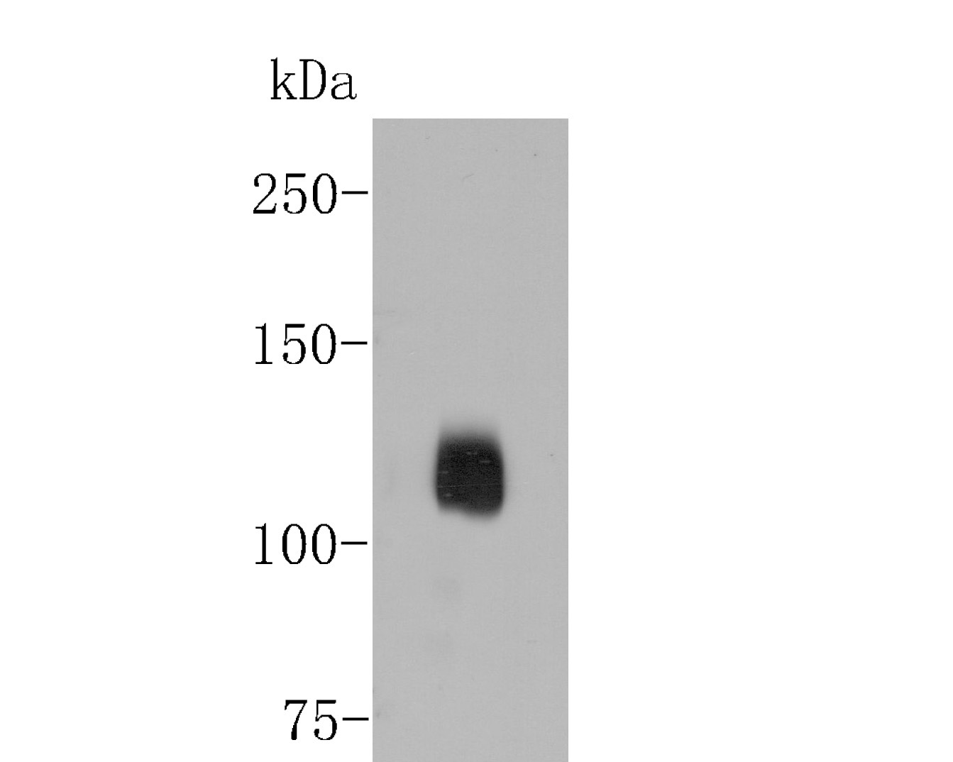Western blot analysis of Metabotropic glutamate receptor 5 on PC-12 cell lysates. Proteins were transferred to a PVDF membrane and blocked with 5% BSA in PBS for 1 hour at room temperature. The primary antibody (ET1609-36, 1/500) was used in 5% BSA at room temperature for 2 hours. Goat Anti-Rabbit IgG - HRP Secondary Antibody (HA1001) at 1:5,000 dilution was used for 1 hour at room temperature.