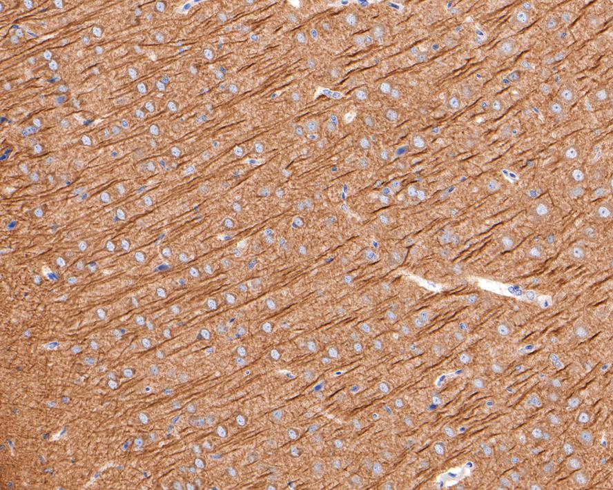 Immunohistochemical analysis of paraffin-embedded rat brain tissue with Rabbit anti-Metabotropic glutamate receptor 5 antibody (ET1609-36) at 1/500 dilution.<br />
<br />
The section was pre-treated using heat mediated antigen retrieval with Tris-EDTA buffer (pH 9.0) for 20 minutes. The tissues were blocked in 1% BSA for 20 minutes at room temperature, washed with ddH2O and PBS, and then probed with the primary antibody (ET1609-36) at 1/500 dilution for 1 hour at room temperature. The detection was performed using an HRP conjugated compact polymer system. DAB was used as the chromogen. Tissues were counterstained with hematoxylin and mounted with DPX.
