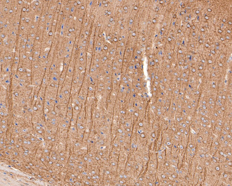 Immunohistochemical analysis of paraffin-embedded mouse brain tissue with Rabbit anti-Metabotropic glutamate receptor 5 antibody (ET1609-36) at 1/200 dilution.<br />
<br />
The section was pre-treated using heat mediated antigen retrieval with Tris-EDTA buffer (pH 9.0) for 20 minutes. The tissues were blocked in 1% BSA for 20 minutes at room temperature, washed with ddH2O and PBS, and then probed with the primary antibody (ET1609-36) at 1/200 dilution for 1 hour at room temperature. The detection was performed using an HRP conjugated compact polymer system. DAB was used as the chromogen. Tissues were counterstained with hematoxylin and mounted with DPX.