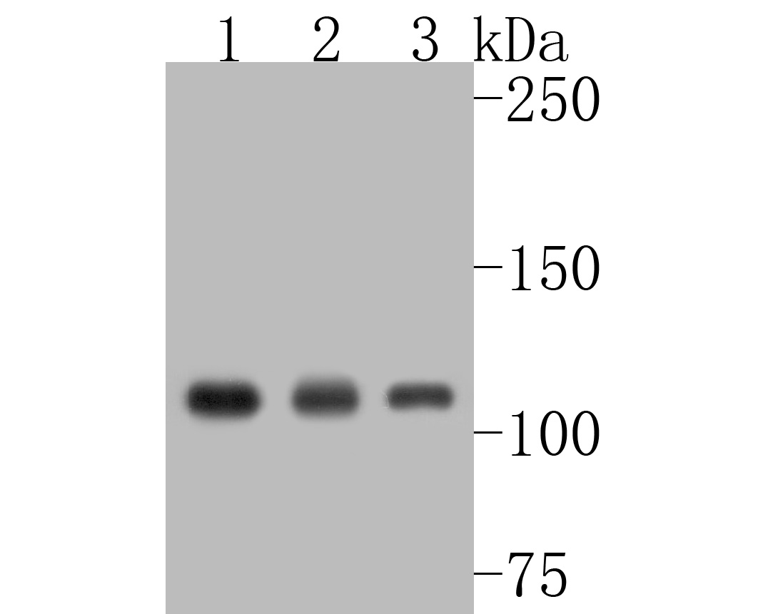 Western blot analysis of ATP citrate lyase on different lysates. Proteins were transferred to a PVDF membrane and blocked with 5% BSA in PBS for 1 hour at room temperature. The primary antibody (ET1609-37, 1/500) was used in 5% BSA at room temperature for 2 hours. Goat Anti-Rabbit IgG - HRP Secondary Antibody (HA1001) at 1:5,000 dilution was used for 1 hour at room temperature.<br />
Positive control: <br />
Lane 1: A549 cell lysate<br />
Lane 2: CRC cell lysate<br />
Lane 3: Hela cell lysate