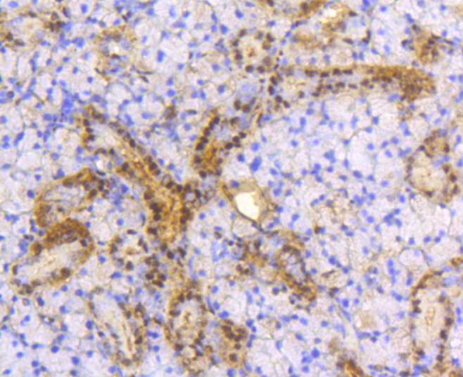 Immunohistochemical analysis of paraffin-embedded human thyroid tissue using anti-ATP citrate lyase antibody. The section was pre-treated using heat mediated antigen retrieval with Tris-EDTA buffer (pH 8.0-8.4) for 20 minutes.The tissues were blocked in 5% BSA for 30 minutes at room temperature, washed with ddH2O and PBS, and then probed with the primary antibody (ET1609-37, 1/50) for 30 minutes at room temperature. The detection was performed using an HRP conjugated compact polymer system. DAB was used as the chromogen. Tissues were counterstained with hematoxylin and mounted with DPX.