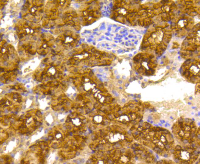 Immunohistochemical analysis of paraffin-embedded mouse kidney tissue using anti-ATP citrate lyase antibody. The section was pre-treated using heat mediated antigen retrieval with Tris-EDTA buffer (pH 8.0-8.4) for 20 minutes.The tissues were blocked in 5% BSA for 30 minutes at room temperature, washed with ddH2O and PBS, and then probed with the primary antibody (ET1609-37, 1/50) for 30 minutes at room temperature. The detection was performed using an HRP conjugated compact polymer system. DAB was used as the chromogen. Tissues were counterstained with hematoxylin and mounted with DPX.