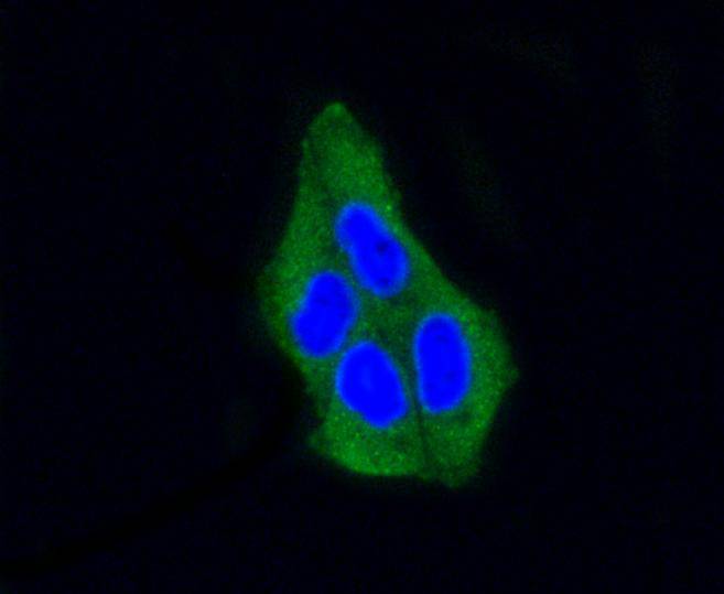 ICC staining of beta Arrestin 1 in Hela cells (green). Formalin fixed cells were permeabilized with 0.1% Triton X-100 in TBS for 10 minutes at room temperature and blocked with 1% Blocker BSA for 15 minutes at room temperature. Cells were probed with the primary antibody (ET1609-38, 1/50) for 1 hour at room temperature, washed with PBS. Alexa Fluor®488 Goat anti-Rabbit IgG was used as the secondary antibody at 1/1,000 dilution. The nuclear counter stain is DAPI (blue).
