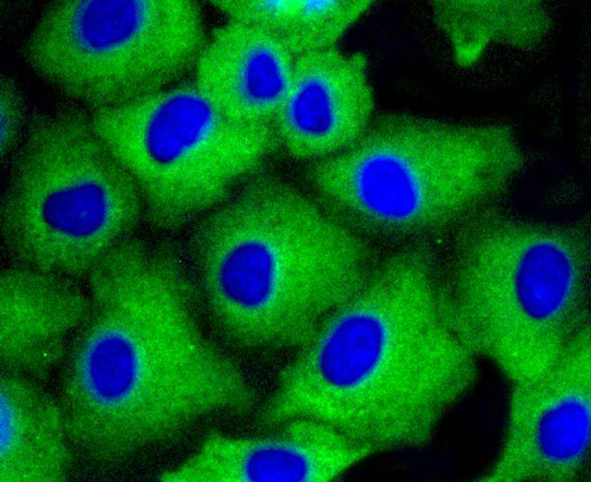 ICC staining of beta Arrestin 1 in A549 cells (green). Formalin fixed cells were permeabilized with 0.1% Triton X-100 in TBS for 10 minutes at room temperature and blocked with 1% Blocker BSA for 15 minutes at room temperature. Cells were probed with the primary antibody (ET1609-38, 1/50) for 1 hour at room temperature, washed with PBS. Alexa Fluor®488 Goat anti-Rabbit IgG was used as the secondary antibody at 1/1,000 dilution. The nuclear counter stain is DAPI (blue).