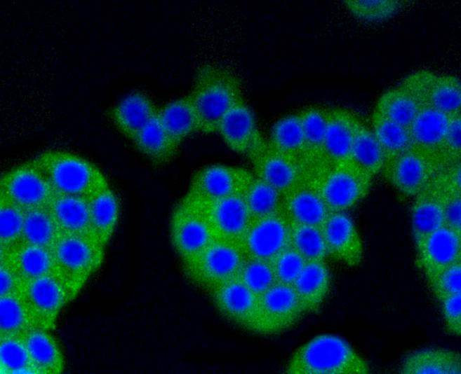 ICC staining of beta Arrestin 1 in PC-12 cells (green). Formalin fixed cells were permeabilized with 0.1% Triton X-100 in TBS for 10 minutes at room temperature and blocked with 1% Blocker BSA for 15 minutes at room temperature. Cells were probed with the primary antibody (ET1609-38, 1/50) for 1 hour at room temperature, washed with PBS. Alexa Fluor®488 Goat anti-Rabbit IgG was used as the secondary antibody at 1/1,000 dilution. The nuclear counter stain is DAPI (blue).