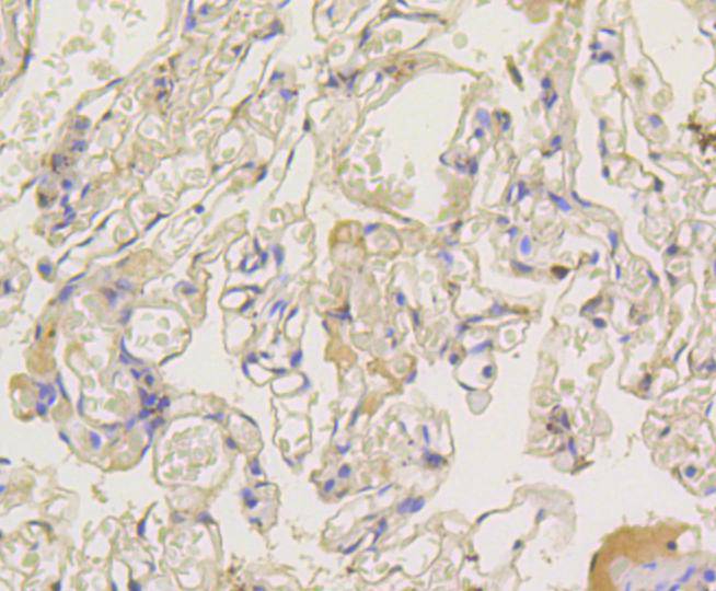 Immunohistochemical analysis of paraffin-embedded human lung tissue using anti-beta Arrestin 1 antibody. The section was pre-treated using heat mediated antigen retrieval with Tris-EDTA buffer (pH 8.0-8.4) for 20 minutes.The tissues were blocked in 5% BSA for 30 minutes at room temperature, washed with ddH2O and PBS, and then probed with the primary antibody (ET1609-38, 1/50) for 30 minutes at room temperature. The detection was performed using an HRP conjugated compact polymer system. DAB was used as the chromogen. Tissues were counterstained with hematoxylin and mounted with DPX.