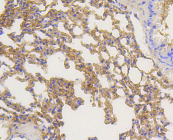 Immunohistochemical analysis of paraffin-embedded mouse lung tissue using anti-beta Arrestin 1 antibody. The section was pre-treated using heat mediated antigen retrieval with Tris-EDTA buffer (pH 8.0-8.4) for 20 minutes.The tissues were blocked in 5% BSA for 30 minutes at room temperature, washed with ddH2O and PBS, and then probed with the primary antibody (ET1609-38, 1/50) for 30 minutes at room temperature. The detection was performed using an HRP conjugated compact polymer system. DAB was used as the chromogen. Tissues were counterstained with hematoxylin and mounted with DPX.