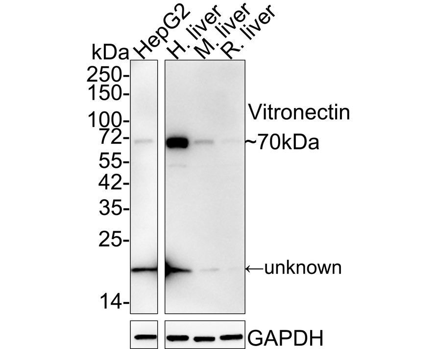 Western blot analysis of Vitronectin on different lysates. Proteins were transferred to a PVDF membrane and blocked with 5% BSA in PBS for 1 hour at room temperature. The primary antibody (ET1609-39, 1/500) was used in 5% BSA at room temperature for 2 hours. Goat Anti-Rabbit IgG - HRP Secondary Antibody (HA1001) at 1:5,000 dilution was used for 1 hour at room temperature.<br />
Positive control: <br />
Lane 1: Human liver tissue lysate<br />
Lane 2: Human serum lysate