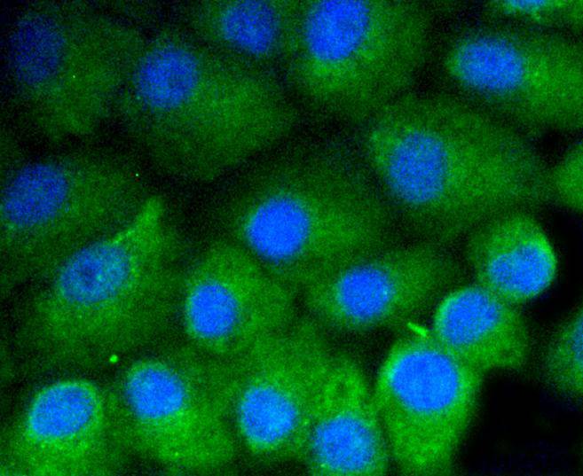 ICC staining of Vitronectin in A549 cells (green). Formalin fixed cells were permeabilized with 0.1% Triton X-100 in TBS for 10 minutes at room temperature and blocked with 1% Blocker BSA for 15 minutes at room temperature. Cells were probed with the primary antibody (ET1609-39, 1/50) for 1 hour at room temperature, washed with PBS. Alexa Fluor®488 Goat anti-Rabbit IgG was used as the secondary antibody at 1/1,000 dilution. The nuclear counter stain is DAPI (blue).
