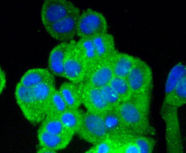 ICC staining of Vitronectin in MCF-7 cells (green). Formalin fixed cells were permeabilized with 0.1% Triton X-100 in TBS for 10 minutes at room temperature and blocked with 1% Blocker BSA for 15 minutes at room temperature. Cells were probed with the primary antibody (ET1609-39, 1/50) for 1 hour at room temperature, washed with PBS. Alexa Fluor®488 Goat anti-Rabbit IgG was used as the secondary antibody at 1/1,000 dilution. The nuclear counter stain is DAPI (blue).
