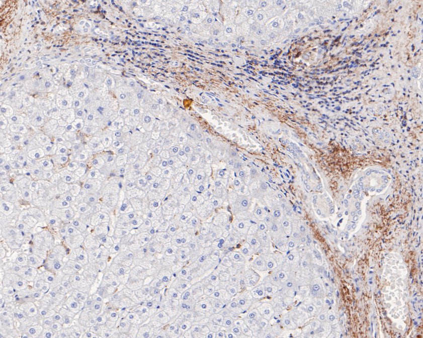 Immunohistochemical analysis of paraffin-embedded human liver tissue using anti-Vitronectin antibody. The section was pre-treated using heat mediated antigen retrieval with Tris-EDTA buffer (pH 8.0-8.4) for 20 minutes.The tissues were blocked in 5% BSA for 30 minutes at room temperature, washed with ddH2O and PBS, and then probed with the primary antibody (ET1609-39, 1/50) for 30 minutes at room temperature. The detection was performed using an HRP conjugated compact polymer system. DAB was used as the chromogen. Tissues were counterstained with hematoxylin and mounted with DPX.