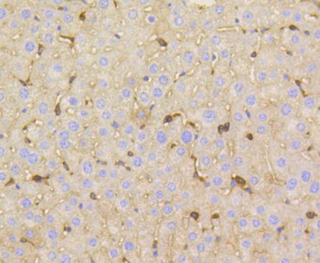 Immunohistochemical analysis of paraffin-embedded mouse liver tissue using anti-Vitronectin antibody. The section was pre-treated using heat mediated antigen retrieval with Tris-EDTA buffer (pH 8.0-8.4) for 20 minutes.The tissues were blocked in 5% BSA for 30 minutes at room temperature, washed with ddH2O and PBS, and then probed with the primary antibody (ET1609-39, 1/50) for 30 minutes at room temperature. The detection was performed using an HRP conjugated compact polymer system. DAB was used as the chromogen. Tissues were counterstained with hematoxylin and mounted with DPX.
