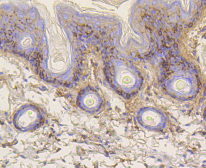 Immunohistochemical analysis of paraffin-embedded mouse skin tissue using anti-Vitronectin antibody. The section was pre-treated using heat mediated antigen retrieval with Tris-EDTA buffer (pH 8.0-8.4) for 20 minutes.The tissues were blocked in 5% BSA for 30 minutes at room temperature, washed with ddH2O and PBS, and then probed with the primary antibody (ET1609-39, 1/50) for 30 minutes at room temperature. The detection was performed using an HRP conjugated compact polymer system. DAB was used as the chromogen. Tissues were counterstained with hematoxylin and mounted with DPX.