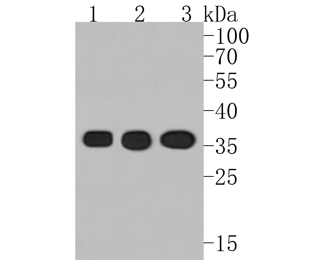 Western blot analysis of Phospho-PP2A(Y307) on different lysates. Proteins were transferred to a PVDF membrane and blocked with 5% BSA in PBS for 1 hour at room temperature. The primary antibody (ET1609-40, 1/500) was used in 5% BSA at room temperature for 2 hours. Goat Anti-Rabbit IgG - HRP Secondary Antibody (HA1001) at 1:5,000 dilution was used for 1 hour at room temperature.<br />
Positive control: <br />
Lane 1: F9 cell lysate<br />
Lane 2: PC-12 cell lysate<br />
Lane 3: A431 cell lysate