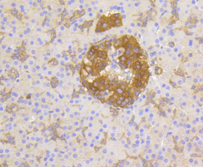 Immunohistochemical analysis of paraffin-embedded human pancreas tissue using anti-Phospho-PP2A(Y307) antibody. The section was pre-treated using heat mediated antigen retrieval with Tris-EDTA buffer (pH 8.0-8.4) for 20 minutes.The tissues were blocked in 5% BSA for 30 minutes at room temperature, washed with ddH2O and PBS, and then probed with the primary antibody (ET1609-40, 1/50) for 30 minutes at room temperature. The detection was performed using an HRP conjugated compact polymer system. DAB was used as the chromogen. Tissues were counterstained with hematoxylin and mounted with DPX.