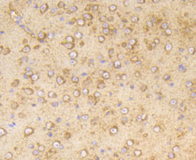 Immunohistochemical analysis of paraffin-embedded mouse brain tissue using anti-Phospho-PP2A(Y307) antibody. The section was pre-treated using heat mediated antigen retrieval with Tris-EDTA buffer (pH 8.0-8.4) for 20 minutes.The tissues were blocked in 5% BSA for 30 minutes at room temperature, washed with ddH2O and PBS, and then probed with the primary antibody (ET1609-40, 1/50) for 30 minutes at room temperature. The detection was performed using an HRP conjugated compact polymer system. DAB was used as the chromogen. Tissues were counterstained with hematoxylin and mounted with DPX.