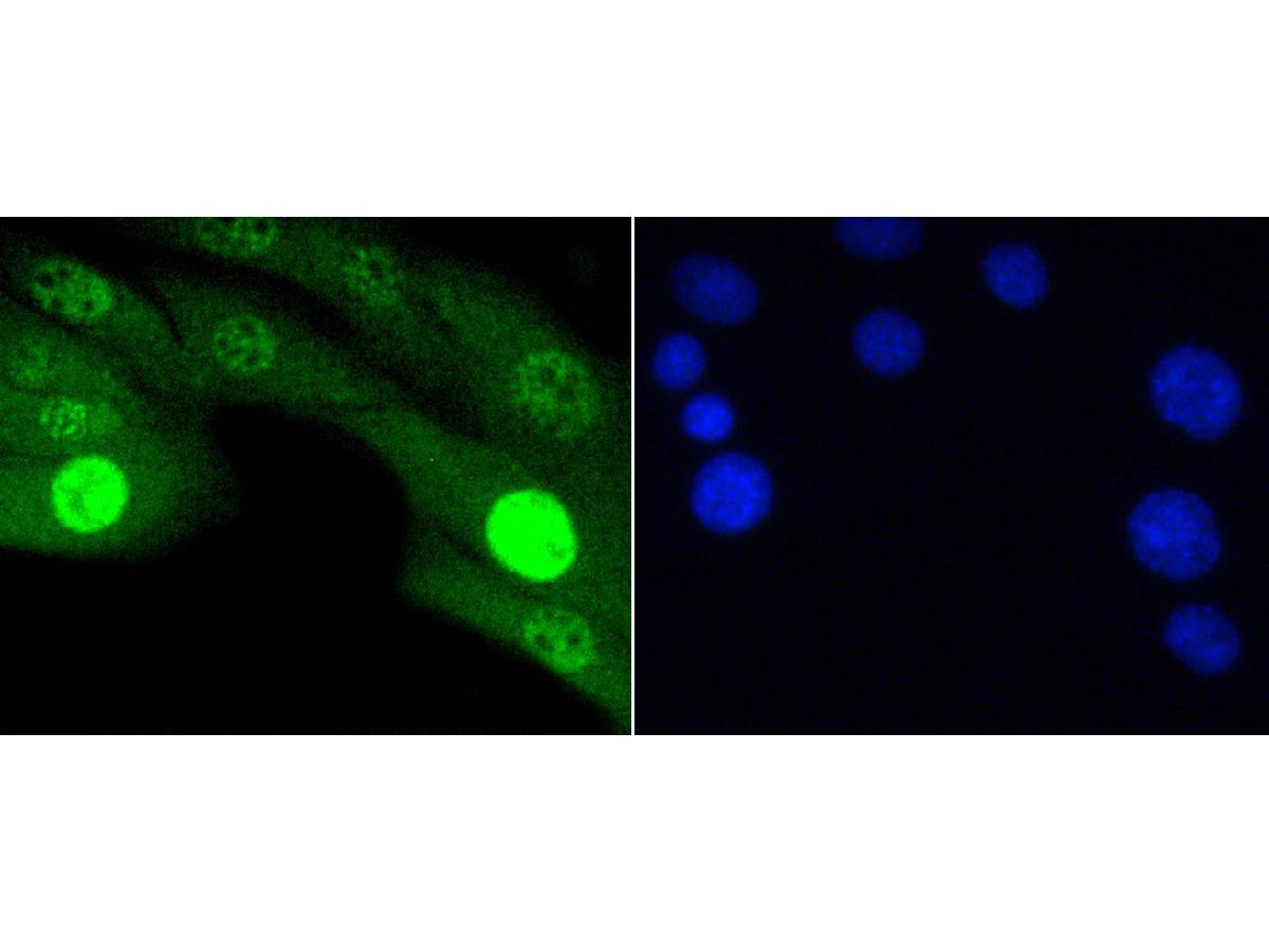ICC staining of Phospho-JNK1/2/3(T183+T183+T221) in HUVEC cells (green). Formalin fixed cells were permeabilized with 0.1% Triton X-100 in TBS for 10 minutes at room temperature and blocked with 1% Blocker BSA for 15 minutes at room temperature. Cells were probed with the primary antibody (ET1609-42, 1/50) for 1 hour at room temperature, washed with PBS. Alexa Fluor®488 Goat anti-Rabbit IgG was used as the secondary antibody at 1/1,000 dilution. The nuclear counter stain is DAPI (blue).