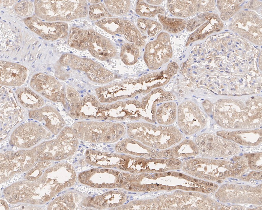 Immunohistochemical analysis of paraffin-embedded mouse liver tissue using anti-PRMT5 antibody. The section was pre-treated using heat mediated antigen retrieval with Tris-EDTA buffer (pH 8.0-8.4) for 20 minutes.The tissues were blocked in 5% BSA for 30 minutes at room temperature, washed with ddH2O and PBS, and then probed with the primary antibody (ET1609-43, 1/50) for 30 minutes at room temperature. The detection was performed using an HRP conjugated compact polymer system. DAB was used as the chromogen. Tissues were counterstained with hematoxylin and mounted with DPX.
