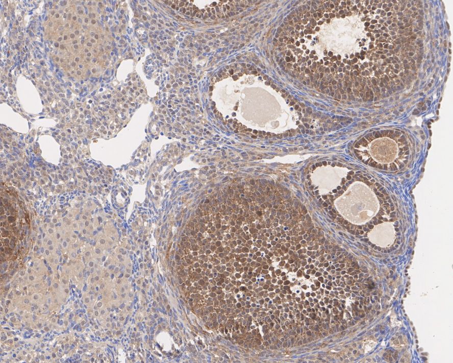 Immunohistochemical analysis of paraffin-embedded mouse kidney tissue using anti-PRMT5 antibody. The section was pre-treated using heat mediated antigen retrieval with Tris-EDTA buffer (pH 8.0-8.4) for 20 minutes.The tissues were blocked in 5% BSA for 30 minutes at room temperature, washed with ddH2O and PBS, and then probed with the primary antibody (ET1609-43, 1/50) for 30 minutes at room temperature. The detection was performed using an HRP conjugated compact polymer system. DAB was used as the chromogen. Tissues were counterstained with hematoxylin and mounted with DPX.