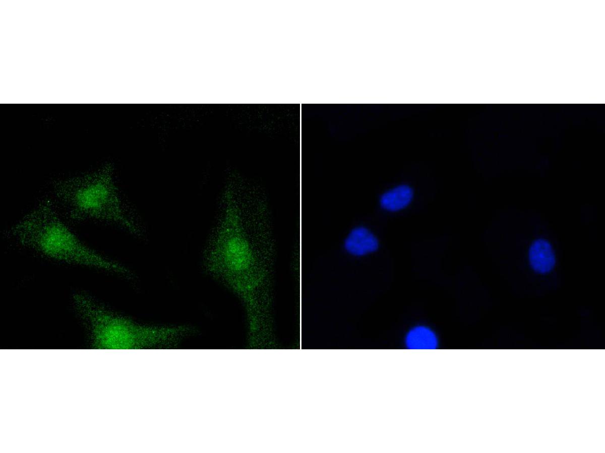 ICC staining of PKC beta 2 in SH-SY5Y cells (green). Formalin fixed cells were permeabilized with 0.1% Triton X-100 in TBS for 10 minutes at room temperature and blocked with 1% Blocker BSA for 15 minutes at room temperature. Cells were probed with the primary antibody (ET1609-44, 1/50) for 1 hour at room temperature, washed with PBS. Alexa Fluor®488 Goat anti-Rabbit IgG was used as the secondary antibody at 1/1,000 dilution. The nuclear counter stain is DAPI (blue).