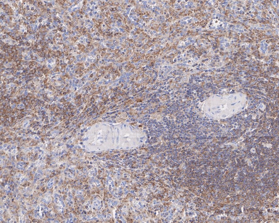 Immunohistochemical analysis of paraffin-embedded human spleen tissue using anti-PKC beta 2 antibody. The section was pre-treated using heat mediated antigen retrieval with Tris-EDTA buffer (pH 8.0-8.4) for 20 minutes.The tissues were blocked in 5% BSA for 30 minutes at room temperature, washed with ddH2O and PBS, and then probed with the primary antibody (ET1609-44, 1/50) for 30 minutes at room temperature. The detection was performed using an HRP conjugated compact polymer system. DAB was used as the chromogen. Tissues were counterstained with hematoxylin and mounted with DPX.