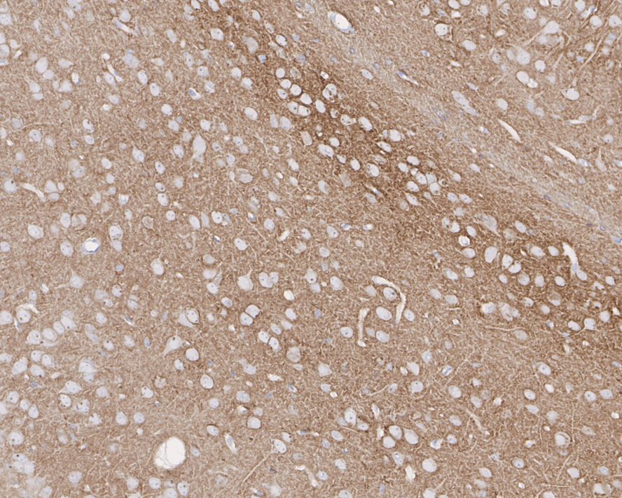 Immunohistochemical analysis of paraffin-embedded mouse brain tissue using anti-PKC beta 2 antibody. The section was pre-treated using heat mediated antigen retrieval with Tris-EDTA buffer (pH 8.0-8.4) for 20 minutes.The tissues were blocked in 5% BSA for 30 minutes at room temperature, washed with ddH2O and PBS, and then probed with the primary antibody (ET1609-44, 1/200) for 30 minutes at room temperature. The detection was performed using an HRP conjugated compact polymer system. DAB was used as the chromogen. Tissues were counterstained with hematoxylin and mounted with DPX.