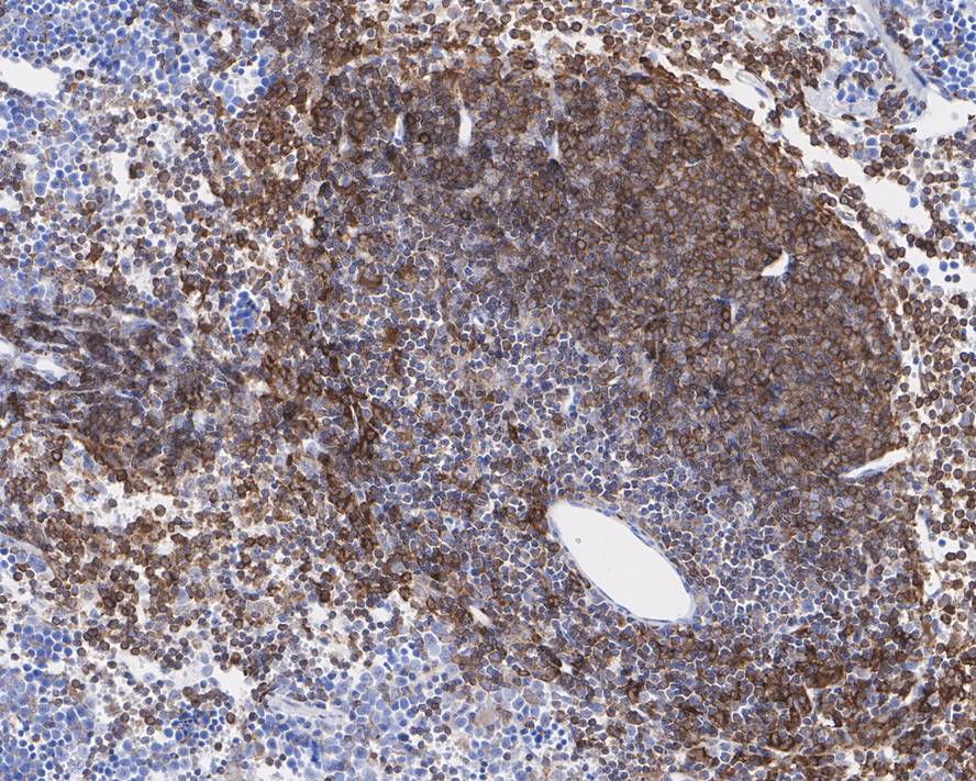 Immunohistochemical analysis of paraffin-embedded mouse spleen tissue with Rabbit anti-PKC beta 2 antibody (ET1609-44) at 1/50 dilution.<br />
<br />
The section was pre-treated using heat mediated antigen retrieval with sodium citrate buffer (pH 6.0) for 2 minutes. The tissues were blocked in 1% BSA for 20 minutes at room temperature, washed with ddH2O and PBS, and then probed with the primary antibody (ET1609-44) at 1/50 dilution for 1 hour at room temperature. The detection was performed using an HRP conjugated compact polymer system. DAB was used as the chromogen. Tissues were counterstained with hematoxylin and mounted with DPX.