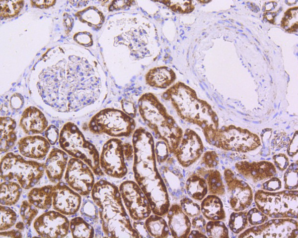 Immunohistochemical analysis of paraffin-embedded mouse skin tissue using anti-Hsp60 antibody. The section was pre-treated using heat mediated antigen retrieval with Tris-EDTA buffer (pH 8.0-8.4) for 20 minutes.The tissues were blocked in 5% BSA for 30 minutes at room temperature, washed with ddH2O and PBS, and then probed with the primary antibody (ET1609-45, 1/50) for 30 minutes at room temperature. The detection was performed using an HRP conjugated compact polymer system. DAB was used as the chromogen. Tissues were counterstained with hematoxylin and mounted with DPX.