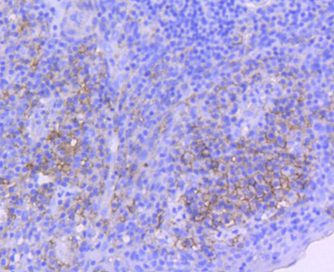 ICC staining of ICAM1 in A431 cells (green). Formalin fixed cells were permeabilized with 0.1% Triton X-100 in TBS for 10 minutes at room temperature and blocked with 1% Blocker BSA for 15 minutes at room temperature. Cells were probed with the primary antibody (ET1609-46, 1/50) for 1 hour at room temperature, washed with PBS. Alexa Fluor®488 Goat anti-Rabbit IgG was used as the secondary antibody at 1/1,000 dilution. The nuclear counter stain is DAPI (blue).
