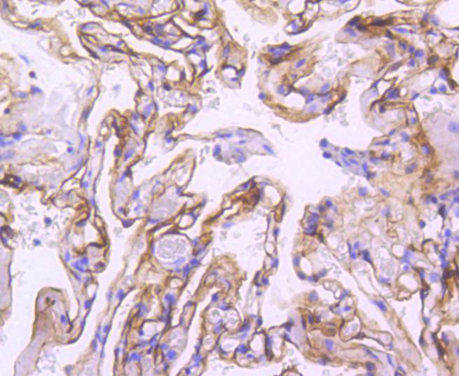 ICC staining of ICAM1 in HUVEC cells (green). Formalin fixed cells were permeabilized with 0.1% Triton X-100 in TBS for 10 minutes at room temperature and blocked with 1% Blocker BSA for 15 minutes at room temperature. Cells were probed with the primary antibody (ET1609-46, 1/50) for 1 hour at room temperature, washed with PBS. Alexa Fluor®488 Goat anti-Rabbit IgG was used as the secondary antibody at 1/1,000 dilution. The nuclear counter stain is DAPI (blue).