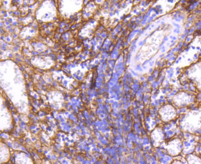 Immunohistochemical analysis of paraffin-embedded human tonsil tissue using anti-ICAM1 antibody. The section was pre-treated using heat mediated antigen retrieval with Tris-EDTA buffer (pH 8.0-8.4) for 20 minutes.The tissues were blocked in 5% BSA for 30 minutes at room temperature, washed with ddH2O and PBS, and then probed with the primary antibody (ET1609-46, 1/50) for 30 minutes at room temperature. The detection was performed using an HRP conjugated compact polymer system. DAB was used as the chromogen. Tissues were counterstained with hematoxylin and mounted with DPX.