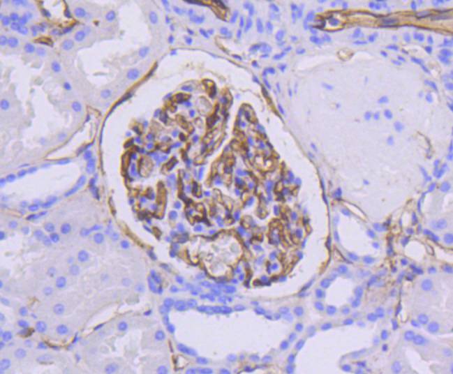 Immunohistochemical analysis of paraffin-embedded human lung tissue using anti-ICAM1 antibody. The section was pre-treated using heat mediated antigen retrieval with Tris-EDTA buffer (pH 8.0-8.4) for 20 minutes.The tissues were blocked in 5% BSA for 30 minutes at room temperature, washed with ddH2O and PBS, and then probed with the primary antibody (ET1609-46, 1/50) for 30 minutes at room temperature. The detection was performed using an HRP conjugated compact polymer system. DAB was used as the chromogen. Tissues were counterstained with hematoxylin and mounted with DPX.