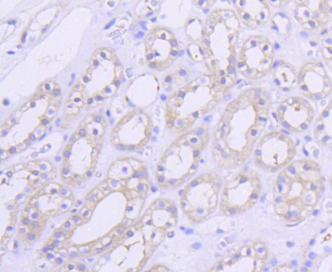 Immunohistochemical analysis of paraffin-embedded human kidney tissue using anti-AKT1 antibody. The section was pre-treated using heat mediated antigen retrieval with Tris-EDTA buffer (pH 8.0-8.4) for 20 minutes.The tissues were blocked in 5% BSA for 30 minutes at room temperature, washed with ddH2O and PBS, and then probed with the primary antibody (ET1609-47, 1/50) for 30 minutes at room temperature. The detection was performed using an HRP conjugated compact polymer system. DAB was used as the chromogen. Tissues were counterstained with hematoxylin and mounted with DPX.