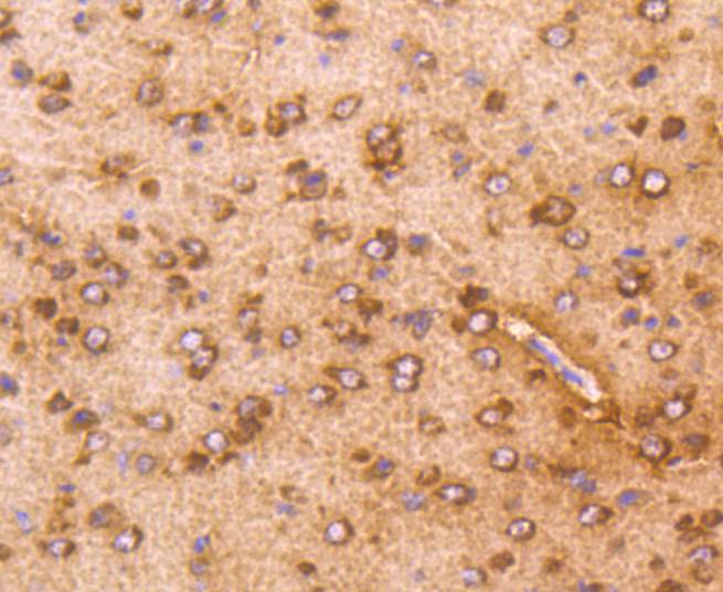 Immunohistochemical analysis of paraffin-embedded mouse prostate tissue using anti-AKT1 antibody. The section was pre-treated using heat mediated antigen retrieval with Tris-EDTA buffer (pH 8.0-8.4) for 20 minutes.The tissues were blocked in 5% BSA for 30 minutes at room temperature, washed with ddH2O and PBS, and then probed with the primary antibody (ET1609-47, 1/50) for 30 minutes at room temperature. The detection was performed using an HRP conjugated compact polymer system. DAB was used as the chromogen. Tissues were counterstained with hematoxylin and mounted with DPX.