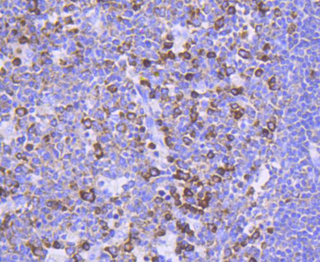 Immunohistochemical analysis of paraffin-embedded human tonsil tissue using anti-Phospho-FOXO3a(S253) antibody. The section was pre-treated using heat mediated antigen retrieval with Tris-EDTA buffer (pH 8.0-8.4) for 20 minutes.The tissues were blocked in 5% BSA for 30 minutes at room temperature, washed with ddH2O and PBS, and then probed with the primary antibody (ET1609-49, 1/50) for 30 minutes at room temperature. The detection was performed using an HRP conjugated compact polymer system. DAB was used as the chromogen. Tissues were counterstained with hematoxylin and mounted with DPX.