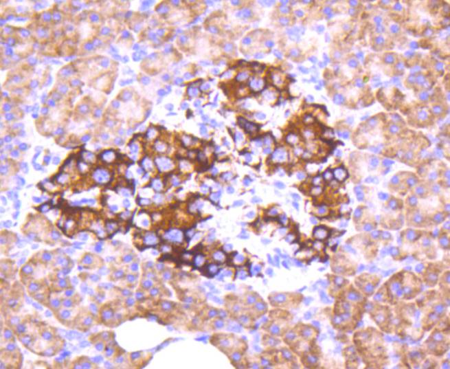 Immunohistochemical analysis of paraffin-embedded human pancreas tissue using anti-Phospho-FOXO3a(S253) antibody. The section was pre-treated using heat mediated antigen retrieval with Tris-EDTA buffer (pH 8.0-8.4) for 20 minutes.The tissues were blocked in 5% BSA for 30 minutes at room temperature, washed with ddH2O and PBS, and then probed with the primary antibody (ET1609-49, 1/50) for 30 minutes at room temperature. The detection was performed using an HRP conjugated compact polymer system. DAB was used as the chromogen. Tissues were counterstained with hematoxylin and mounted with DPX.